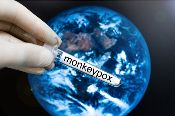 You are currently viewing Variole du singe (monkeypox) : mobilisation de la réserve sanitaire !